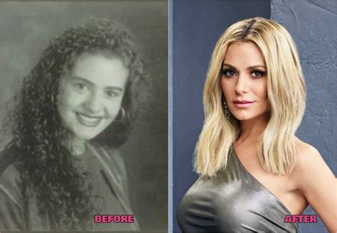 khiemslay|dorit kemsley before and after.